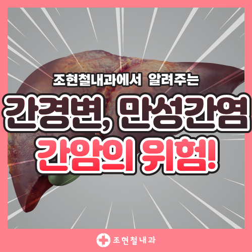 간암 초기 증상, 주범은 만성 간염? 16