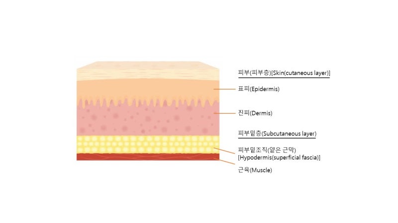 part6.근막의 깊이 - 얕은 근막(Superficial fascia) vs 깊은 근막(Deep fascia)[대구재활-엠앤 ...
