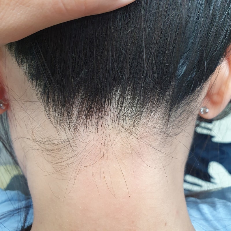 지루성두피샴푸 확실히 효과가 느껴지는 레베코코