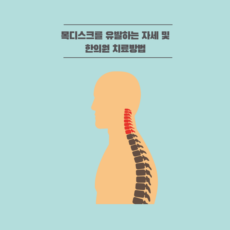  목디스크를 유발하는 자세(한의원 치료방법)