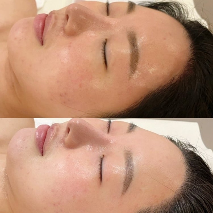 동탄 평택 스킨케어 더 늦기 전에 시작해보자.