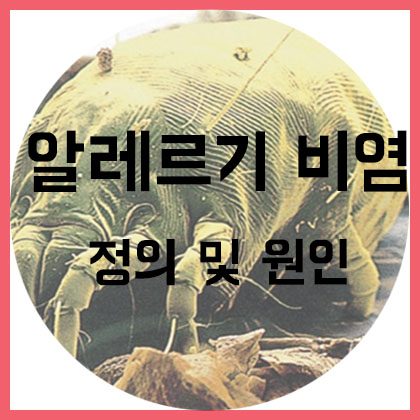  [코] 알레르기 비염 - 정의 및 원인