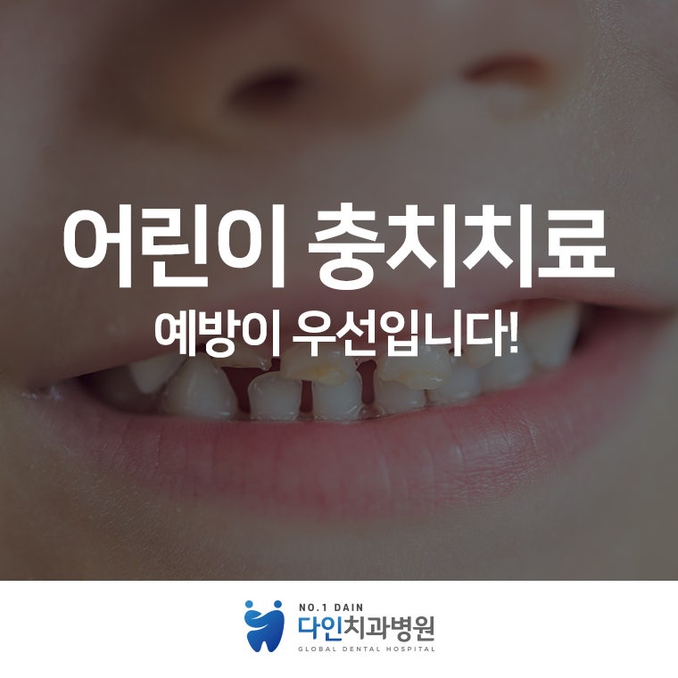 어린이 충치 예방 치료[이거] 치료하면 안심이에요. 2