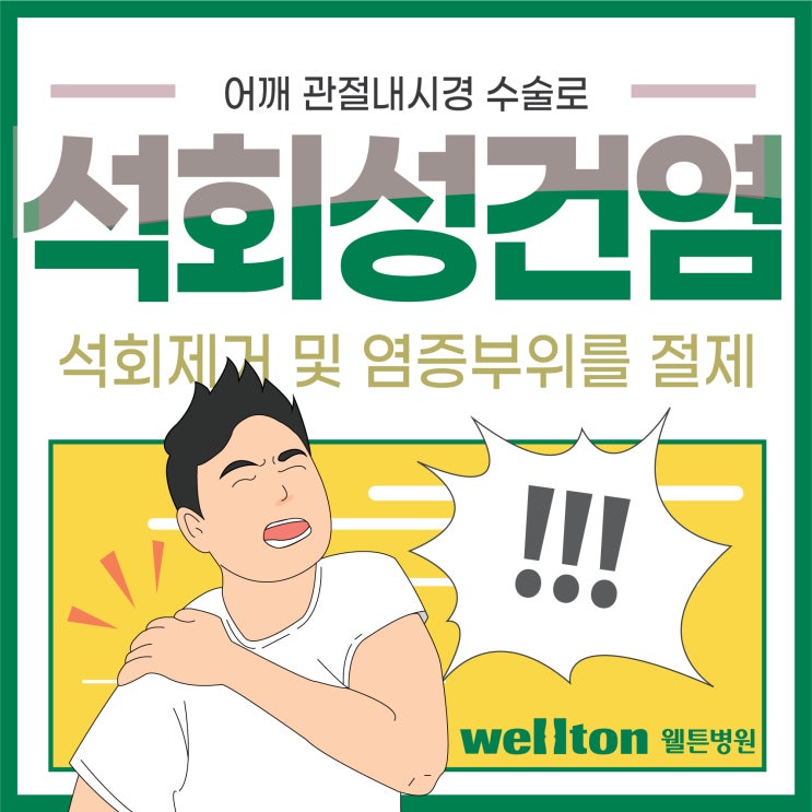  마곡역어깨병원 심한 석회성건염 관절내시경수술 효과적!