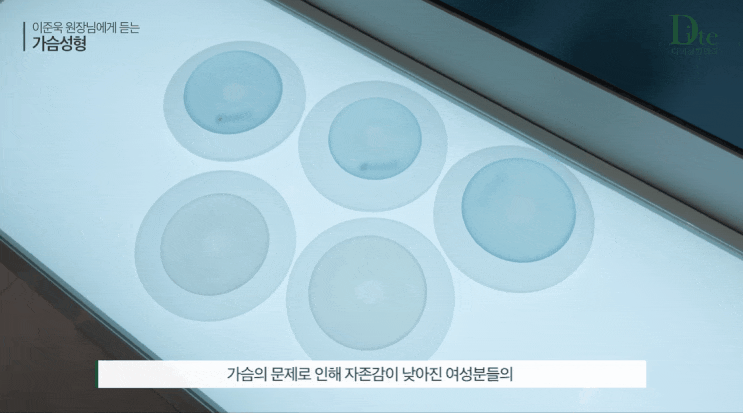  강남가슴수술, 후기가 아니라 이 2가지를 확인해야 합니다