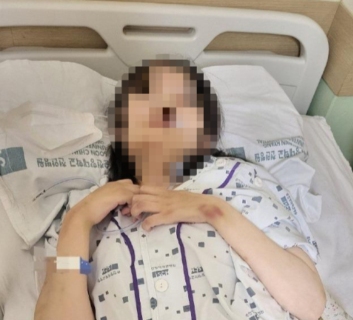 딸 출산 후 2년째 식물인간 안성시 산부인과 이름 제왕절개 수술후 딸 출산 후 2년째 식물인간 안성시 산부인과 이름 제왕절개 수술후