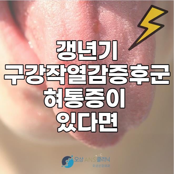 구강작열감증후군 혓바닥에 통증과 11
