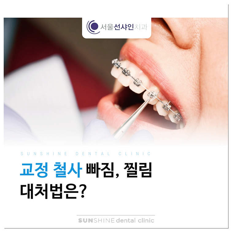 교정철사빠짐, 찔림 현상 대처법은? : 네이버 블로그 교정철사빠짐, 찔림 현상 대처법은? : 네이버 블로그