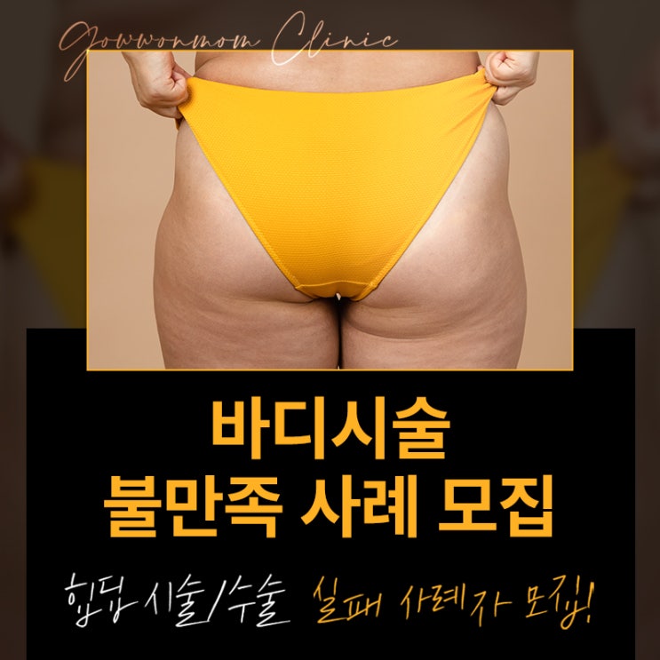  ※망한 힙딥 갱생 프로젝트※ 힙딥성형 불만족 사례 모집합니다!
