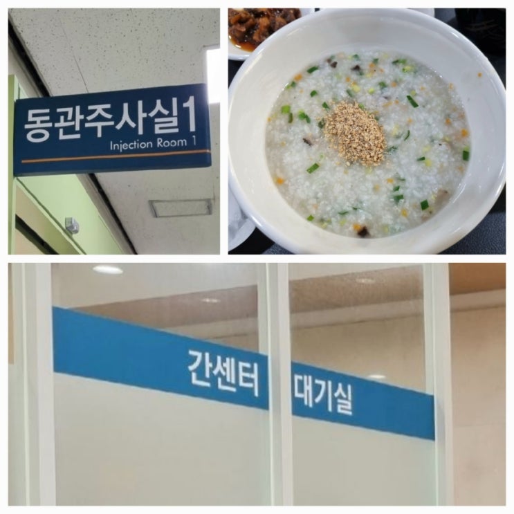  서울아산병원 2차 항암주사치료 티센트릭/아바스틴