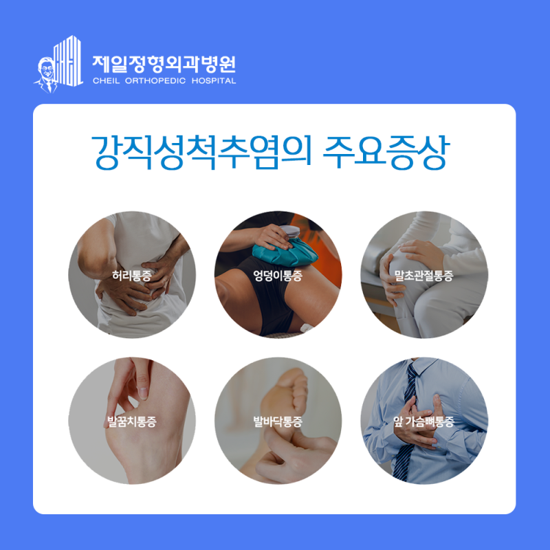 강직성 척추염의 원인과 증상은? 위업. 제일정형외과 척추센터장 서진석 4