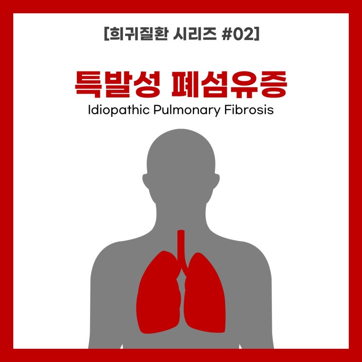 [희귀질환 시리즈 #02] 특발성 폐섬유증
