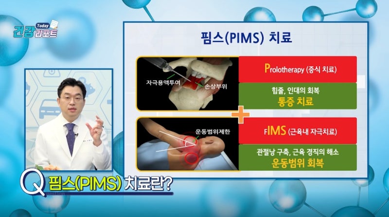 회전근 개 파열 치료, 비수술적 PIMS 치료 접근