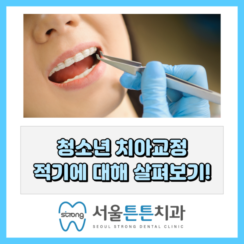 치아 교정 치료의 적기 시기를 정하는 방법은? 3