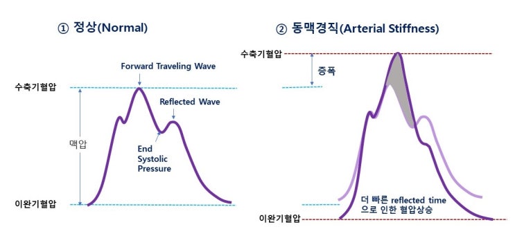  심장펌프, 근육펌프, 호흡펌프, 맥파(pulse wave)와 동맥경직도(arterial stiffness), 정맥환류(venus return)