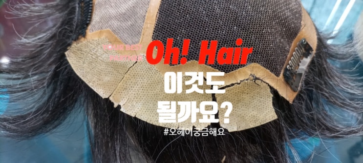  맞춤가발 조각난 앞스킨수선도 수선이 될까요?
