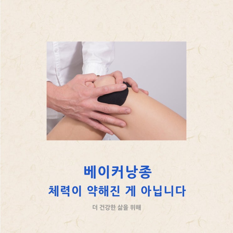  베이커낭종 체력이 약해진 게 아닙니다