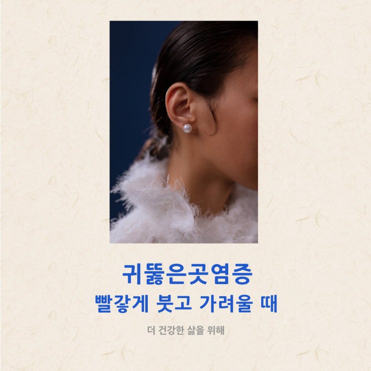  귀뚫은곳염증 빨갛게 붓고 가려울 때