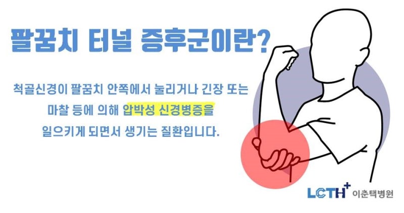 손가락이 심할 때 손목터널증후군 치료법이 궁금하다면? 6