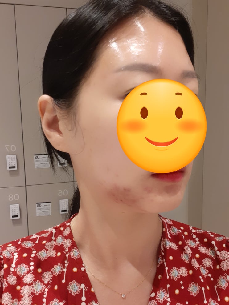  키오머3 받고 온 2차 후기