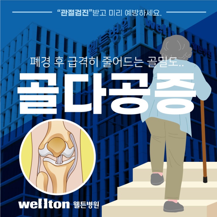  마곡동병원, 골밀도검사로 알 수 있는 질환은?