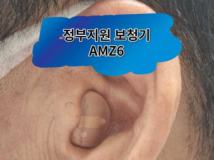  벨톤 정부지원 귓속형 보청기 어메이즈(AMZ6) 착용후기~