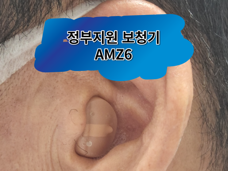 벨톤 정부지원 귓속형 보청기 어메이즈(AMZ6) 착용후기~