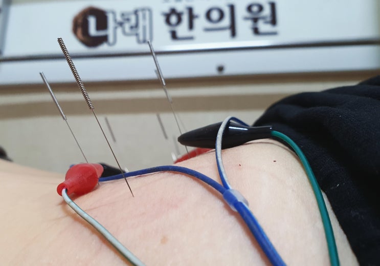 신부동 한의원 방문이 처음이예요