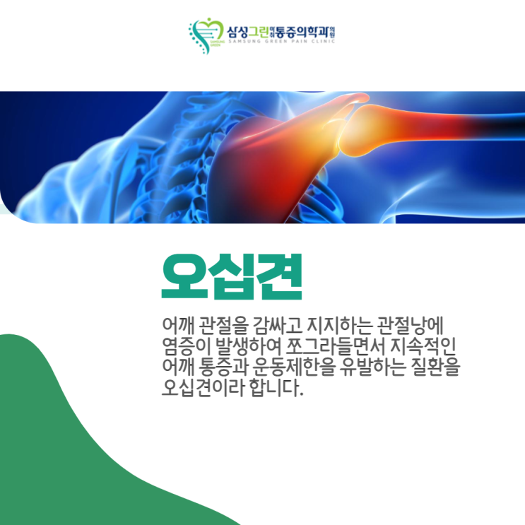  '마두 정형외과' 반복되는 어깨 부위 통증과 경직감, 오십견 증상일 수 있습니다.