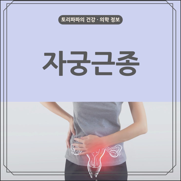 자궁근종 증상 및 원인, 치료