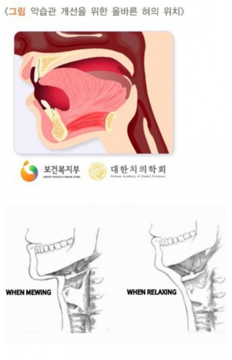  혀 위치만 바꿔도 잘생기고 예뻐진다? 뮤잉운동!