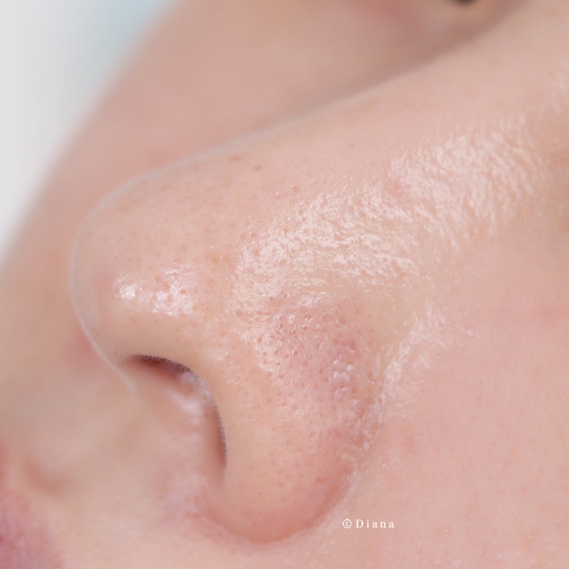 장영란 피지패드 내 돼지 내장 코 피지 제거 실패 리뷰...