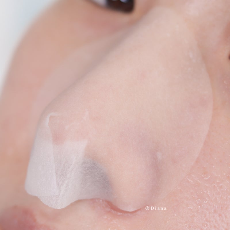 장영란 피지패드 내 돼지 내장 코 피지 제거 실패 리뷰... 9