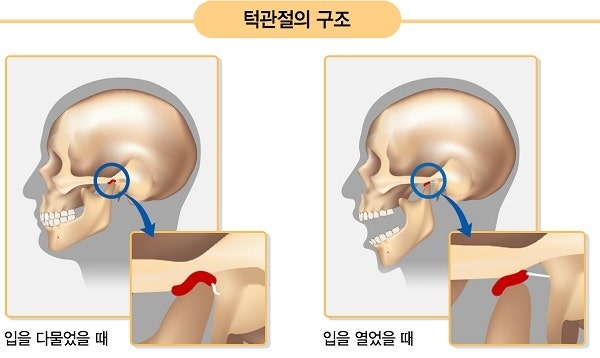 턱관절 장애의 증상 및 원인과 도수치료 서초구 방배동 이수역 강남성모정형외과
