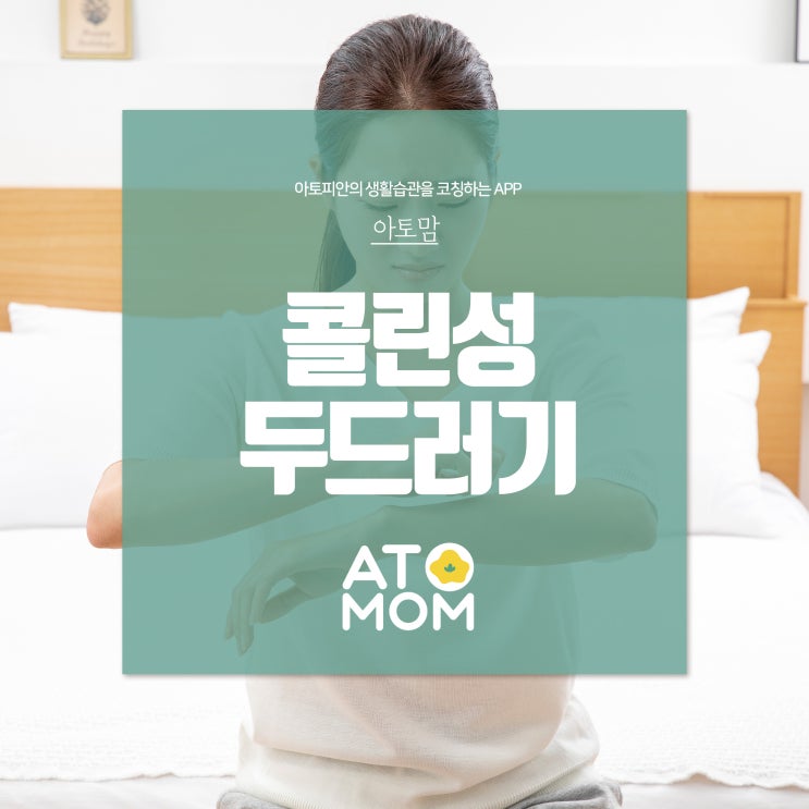  콜린성 두드러기 및 알레르기 원인과 대처