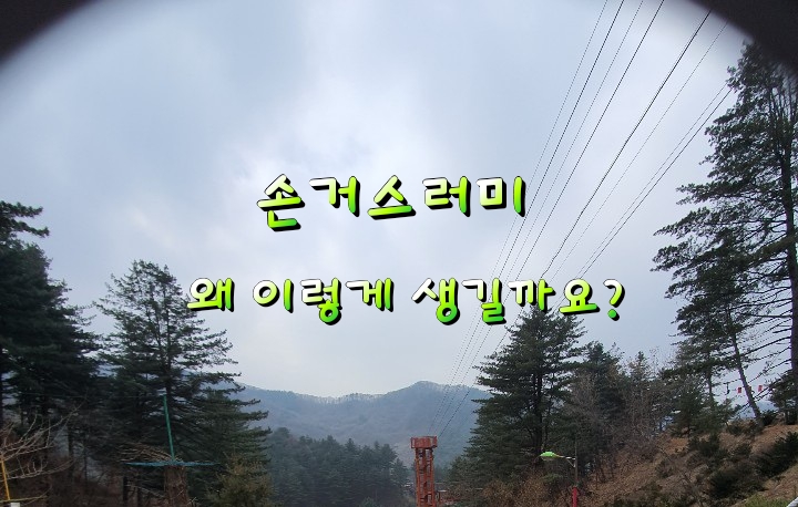 손거스러미  왜 이렇게 생길까요?