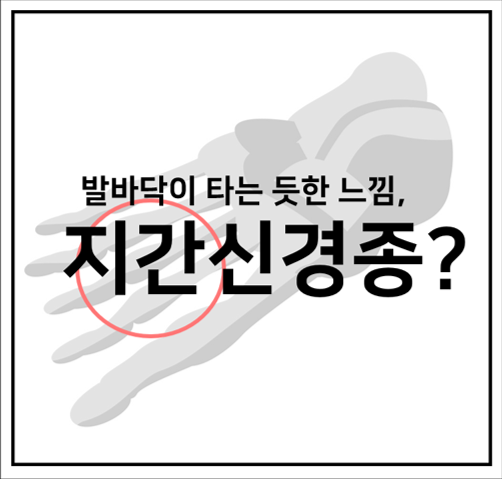  부천야간한의원 :: 발바닥 앞쪽의 타는 듯한 통증, 원인은 지간신경종?