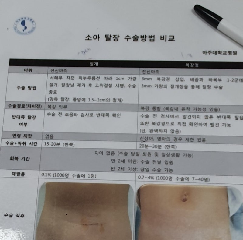 대학병원에서 소아 서혜부탈장 수술 후기
