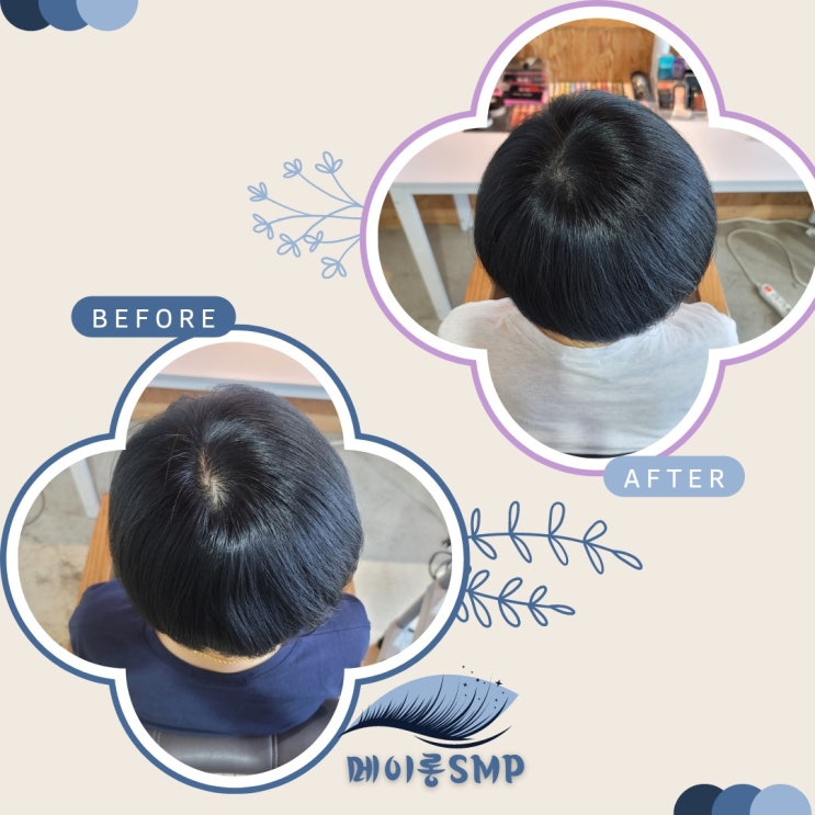  탈모인은 메이롱뷰티에서 만나요