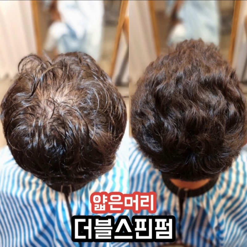 탈모펌 머리숱없는남자펌탈모   m자탈모펌 정수리탈모파마 남자탈모 탈모펌미용실