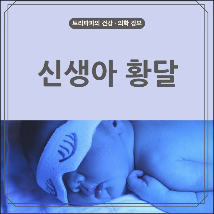  신생아 황달 원인 종류 치료 확인 방법
