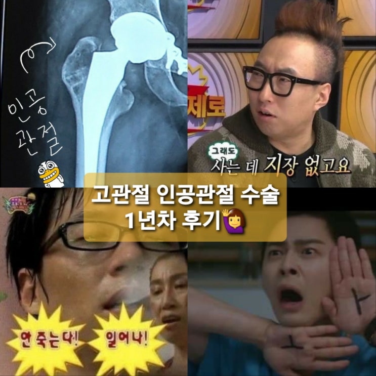  고관절 무혈성괴사 판정으로 인한 《고관절 인공관절 수술》 1년차 후기 수술Q&A️