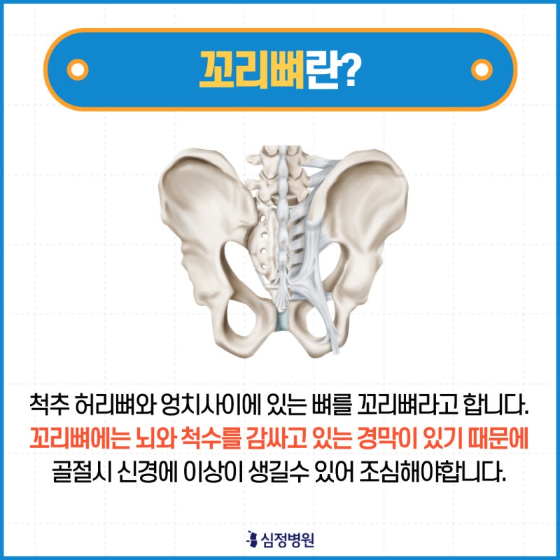 꼬리뼈 통증의 원인 예방법 척추 건강 지키기!