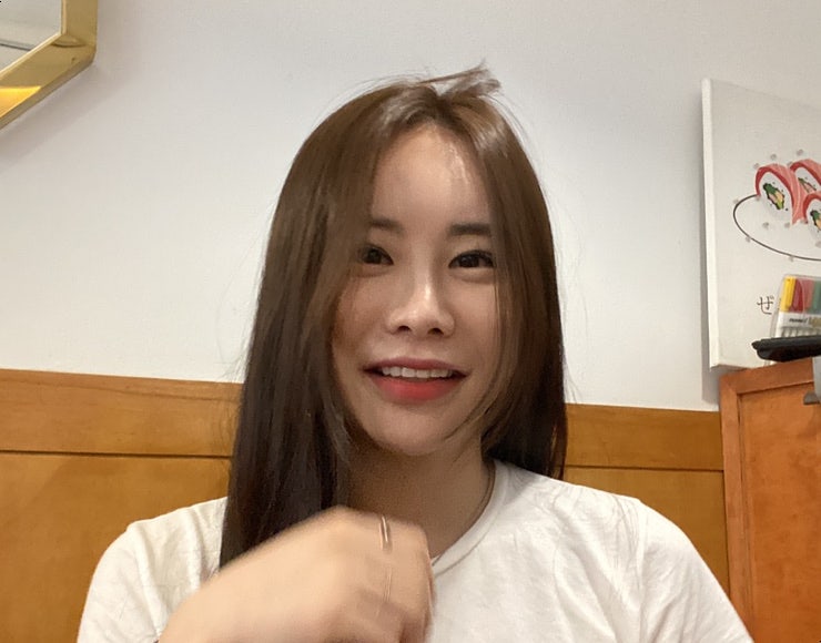 콧볼축소수술 재수술 후기 1년차 11