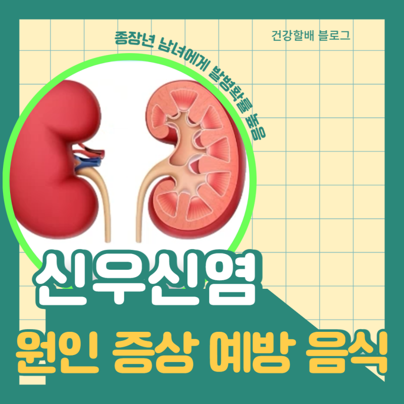 신우 신장염에 좋은 것이 무엇인지 알아보겠습니다!