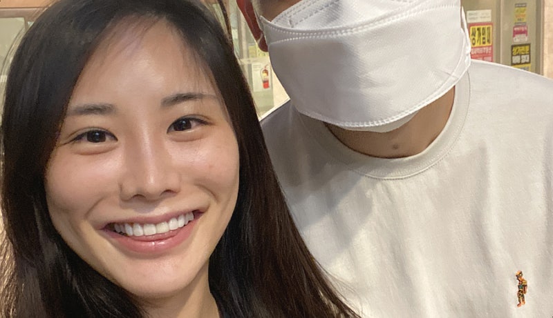 콧볼축소수술 재수술 후기 1년차 9