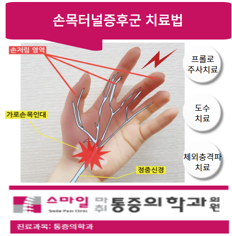  [일산 손목터널증후군병원] 손목터널증후군 자가진단과 치료법 및 예방법