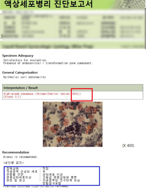 자궁경부암 국가검진 무료대상, 증상 및 검사결과 예약병원