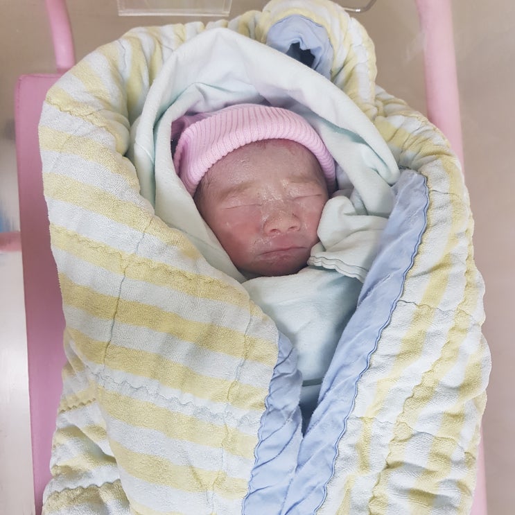  신생아 황달에 대해 알아보기/미소의 횡달