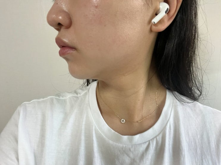 여름맞이 잠실피부과에서 리프팅레이저 인모드리프팅 받고 왔어요! 솔직 후기! 여름맞이 잠실피부과에서 리프팅레이저 인모드리프팅 받고 왔어요! 솔직 후기!